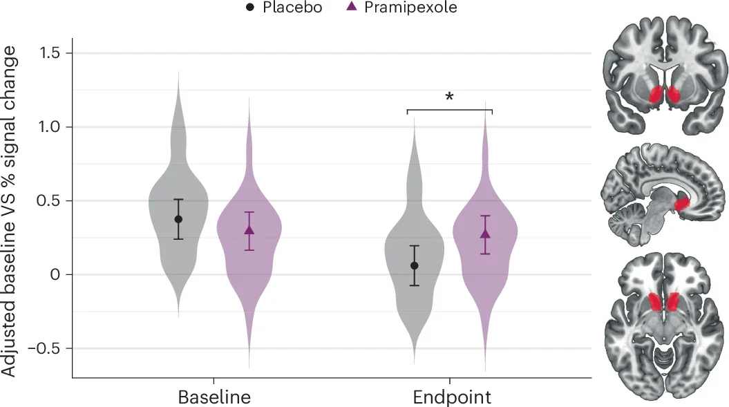 Effects of pramipexole on reward‑related ventral striatal BOLD activation.