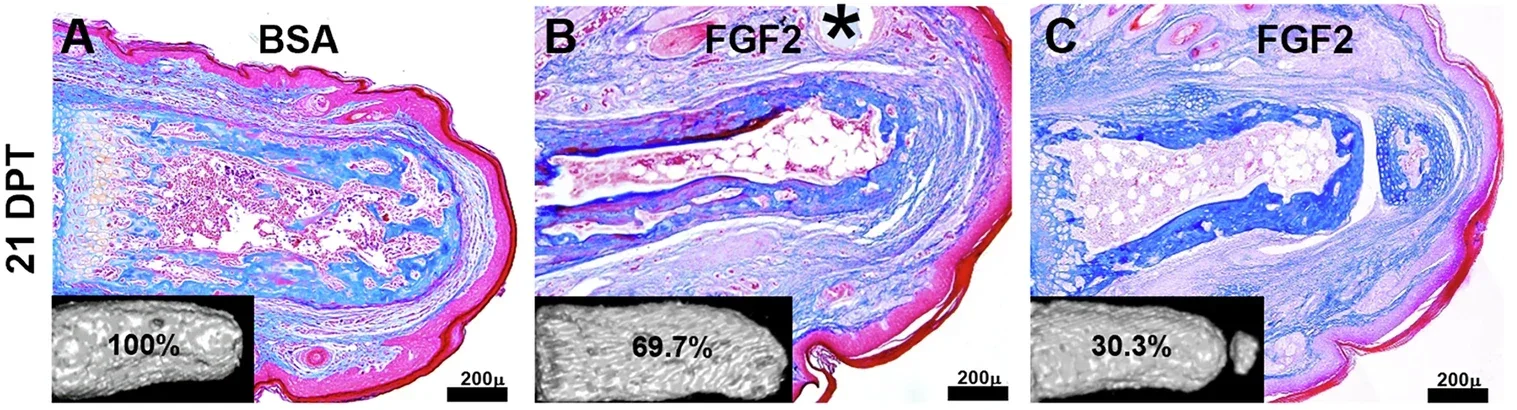 Representative longitudinal sections and μCT images (insets) of control and FGF2 treated digits 21 days post treatment (DPT).