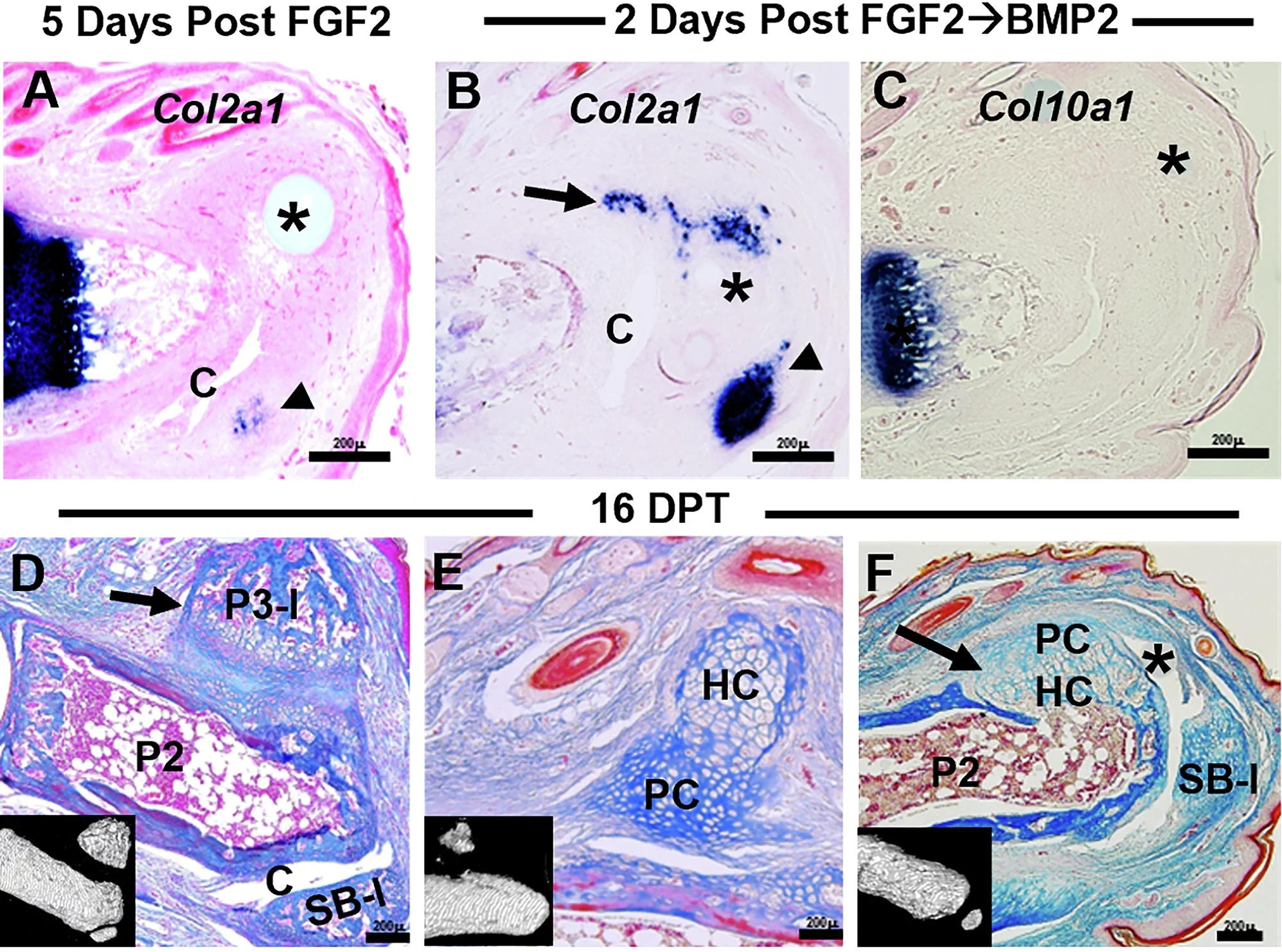 Sequential FGF2 and BMP2 treatment stimulates growth plate regeneration.