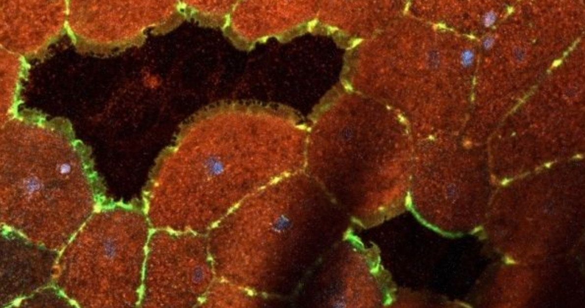 Two small wounds can be seen in the sheet of epithelial cells in this confocal image (right). Membranes (red), nuclei (blue) and actin (green).