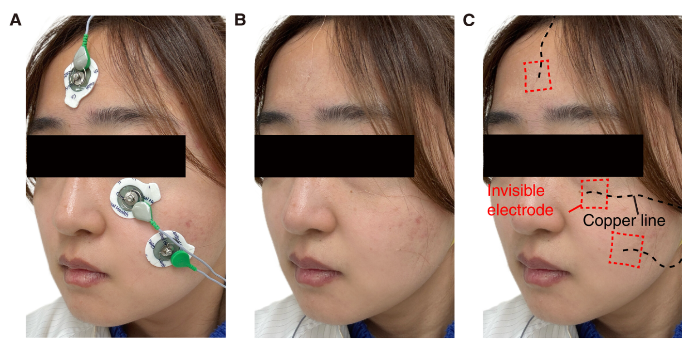 Facial electrophysiological signals monitoring by invisible electrodes.