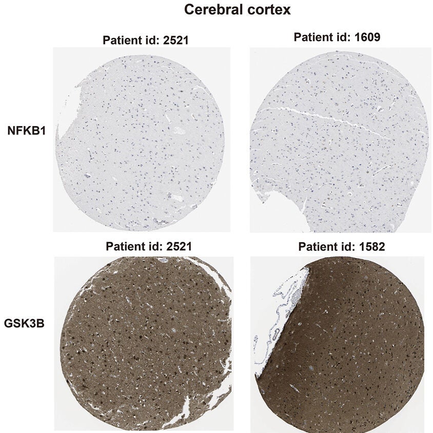 Immunohistochemical staining of NFKB1 and GSK3B in human brain tissues from the Human Protein Atlas database.