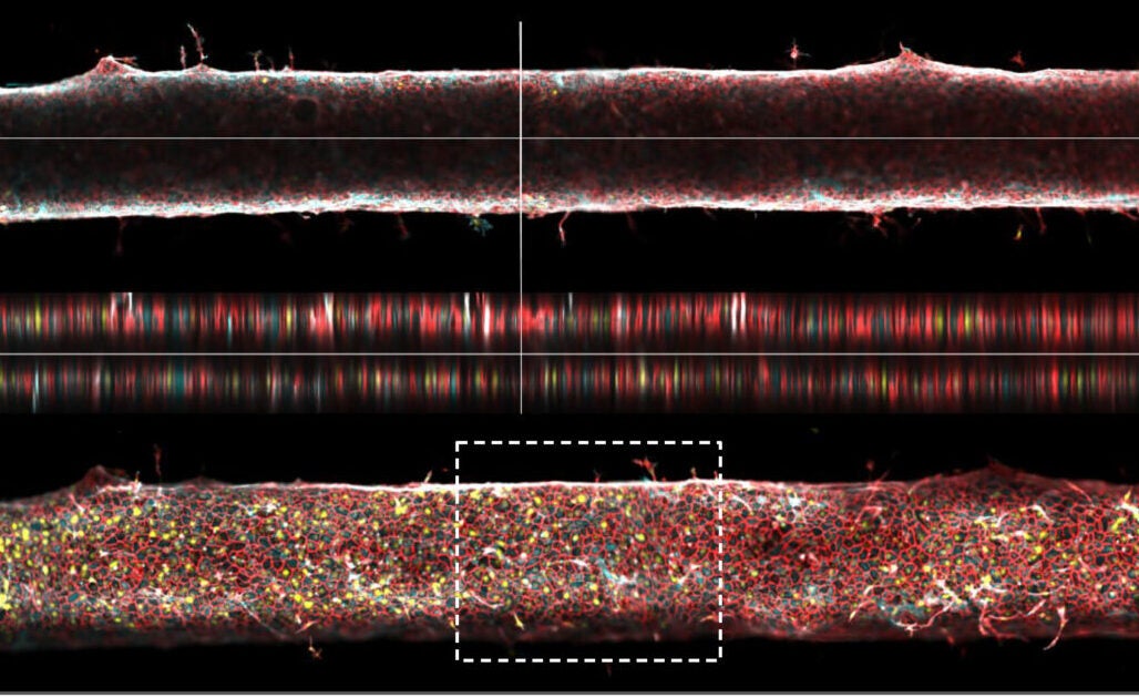 MIT scientists develop a new way to grow artificial blood vessels