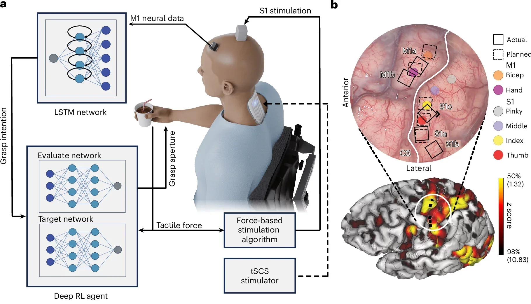 Schematic showing the DNB system including intraoperative image of the brain showing M1 and S1 with the central sulcus.