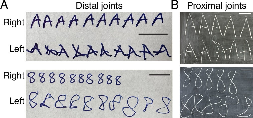 Examples of handedness for handwriting with distal and proximal joints. (A) Examples of writing the letter “A” and the number “8” with Right and Left hands on a piece of paper. The scale bars in both images represent 1 cm. (B) Same as (A), but written on a blackboard, requiring movements of proximal upper extremity joints.
