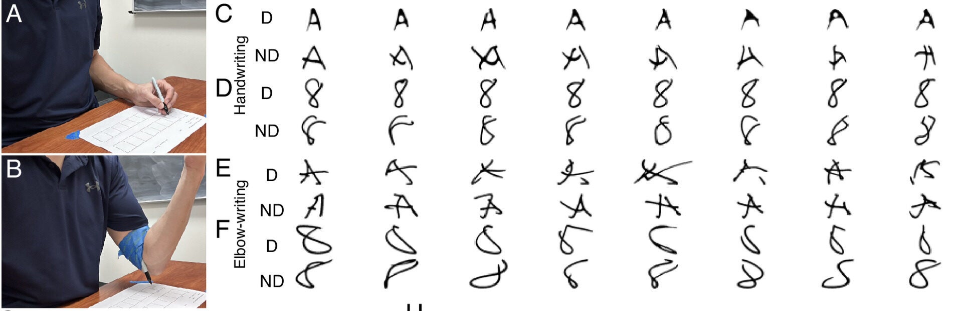 Writing with a de novo effector (elbow) abolished the dominant/nondominant difference.
