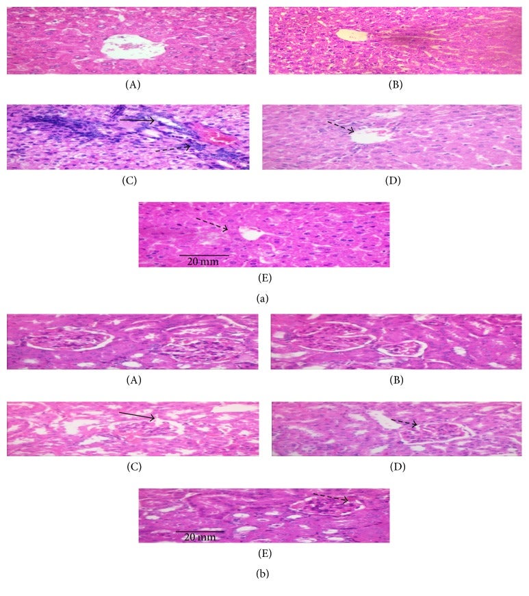 Effect of GLE on the liver histology of the control and experimental rats (A) and (B) shows normal histology of liver with central vein.