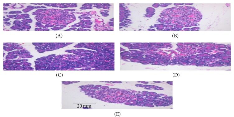 Effect of GLE on the pancreas histology of the control and experimental rats.