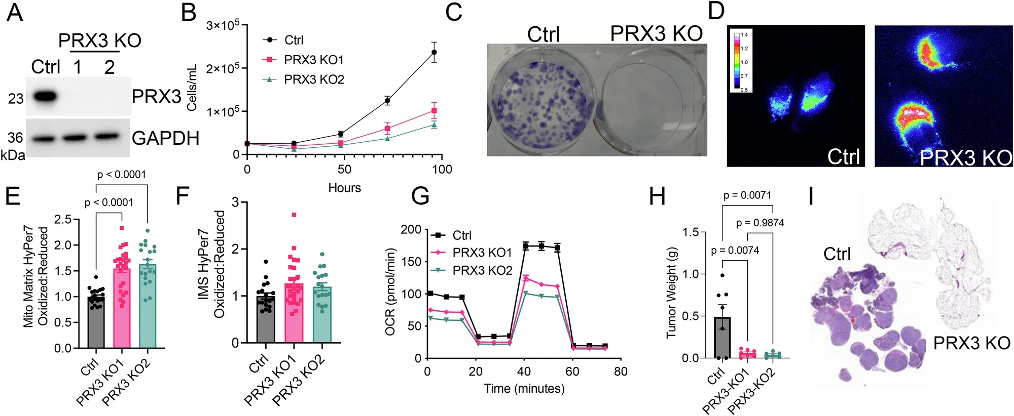 Peroxiredoxin 3 (PRX3) supports mesothelioma redox status, proliferation, and in vivo tumor growth.