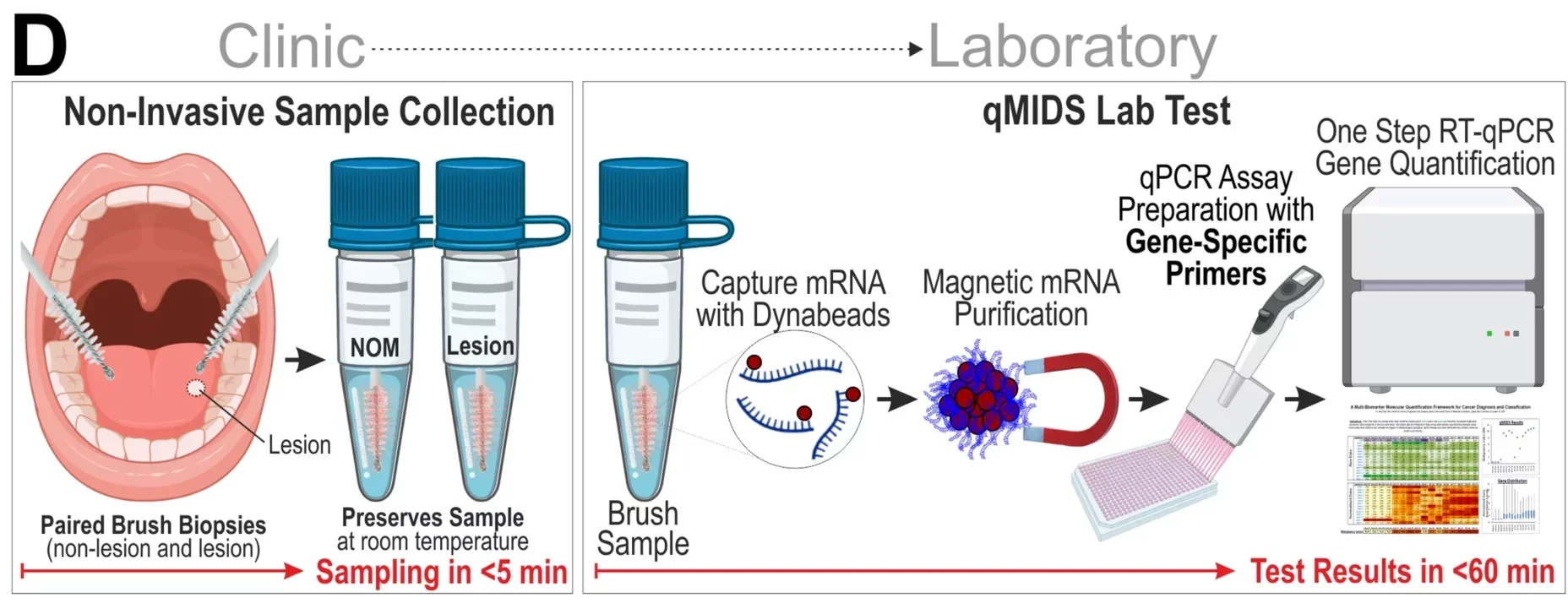 An overview of qMIDS test workflow. At the clinic, paired non-invasive brush biopsy samples were taken from each patient, one from non-lesional oral mucosa (NOM) and another from the oral lesion (test site) using cytological brushes