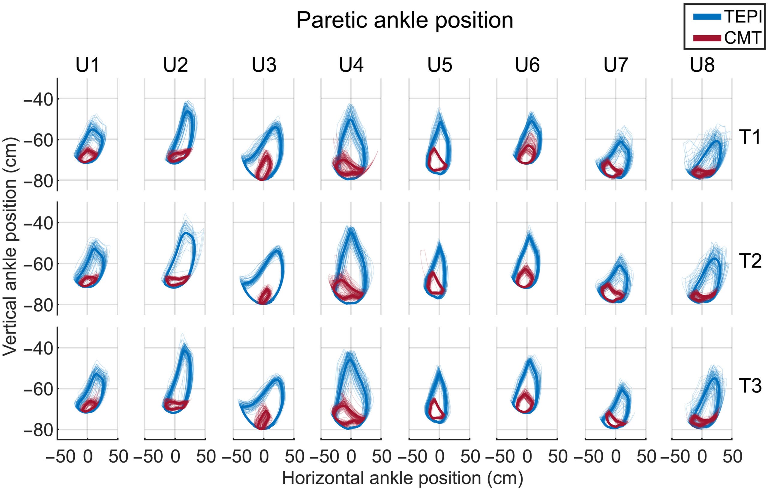 Paretic ankle trajectories during training.