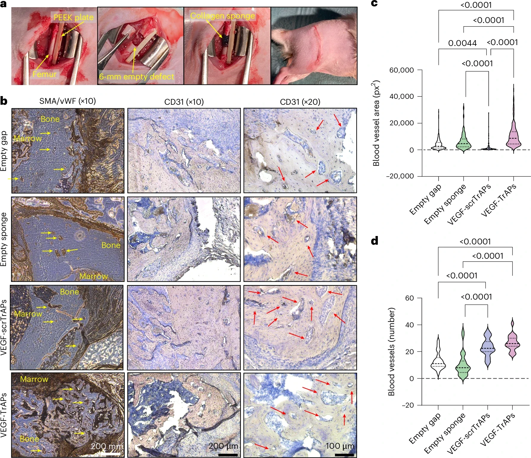 VEGF-TrAP-functionalized collagen sponges promote angiogenesis during bone repair.