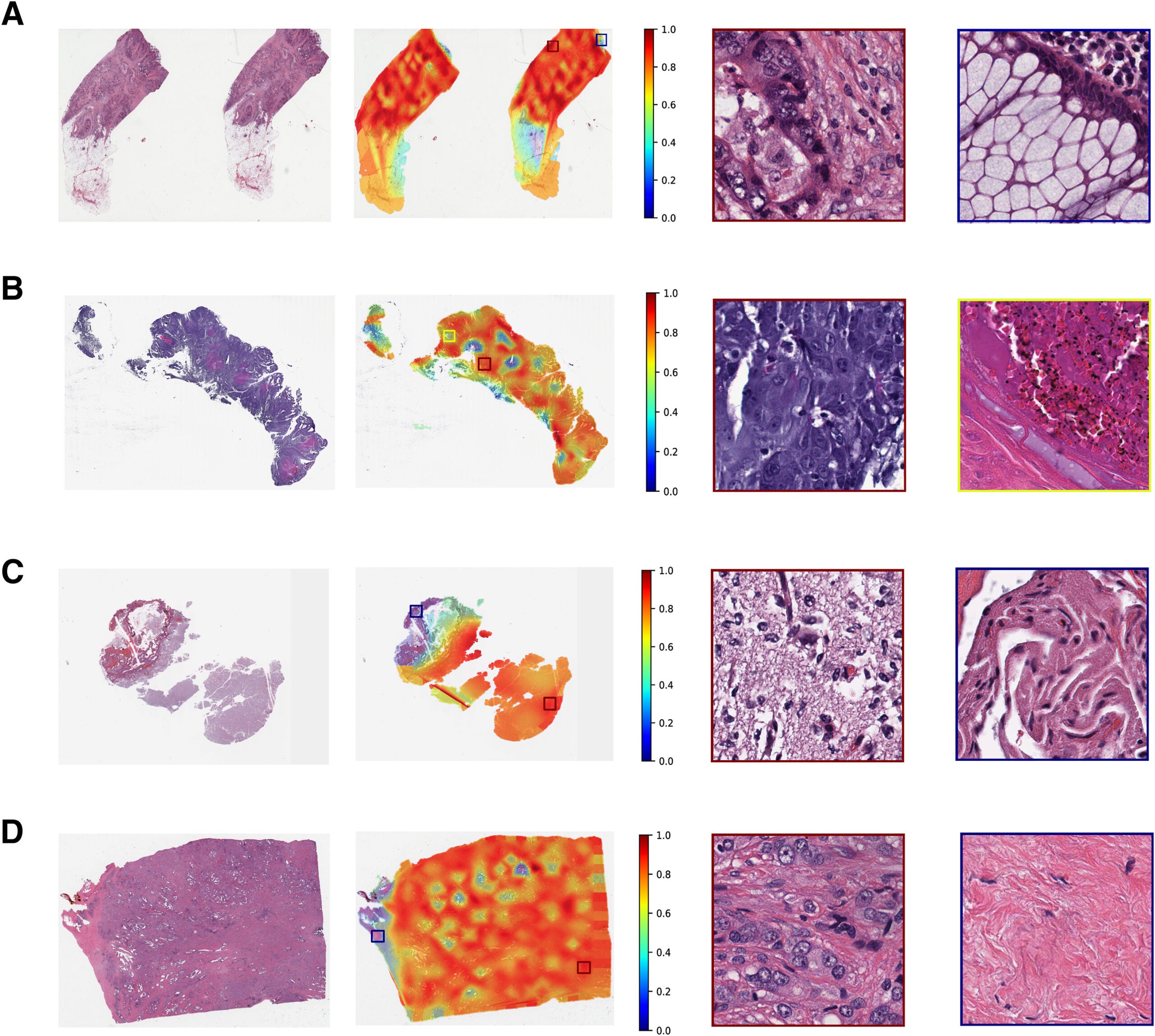 The fine-tuned model predicted seven outputs using whole slide images (WSIs).