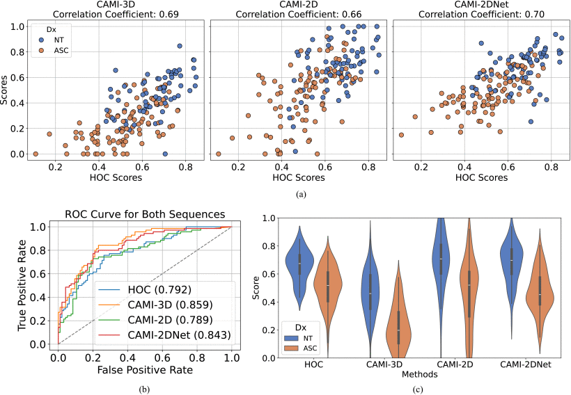Comparing CAMI-2DNet, CAMI-2D, CAMI-3D, and human observation coding (HOC) on the CAMI-47 dataset (27 ASCs, 20 NT).