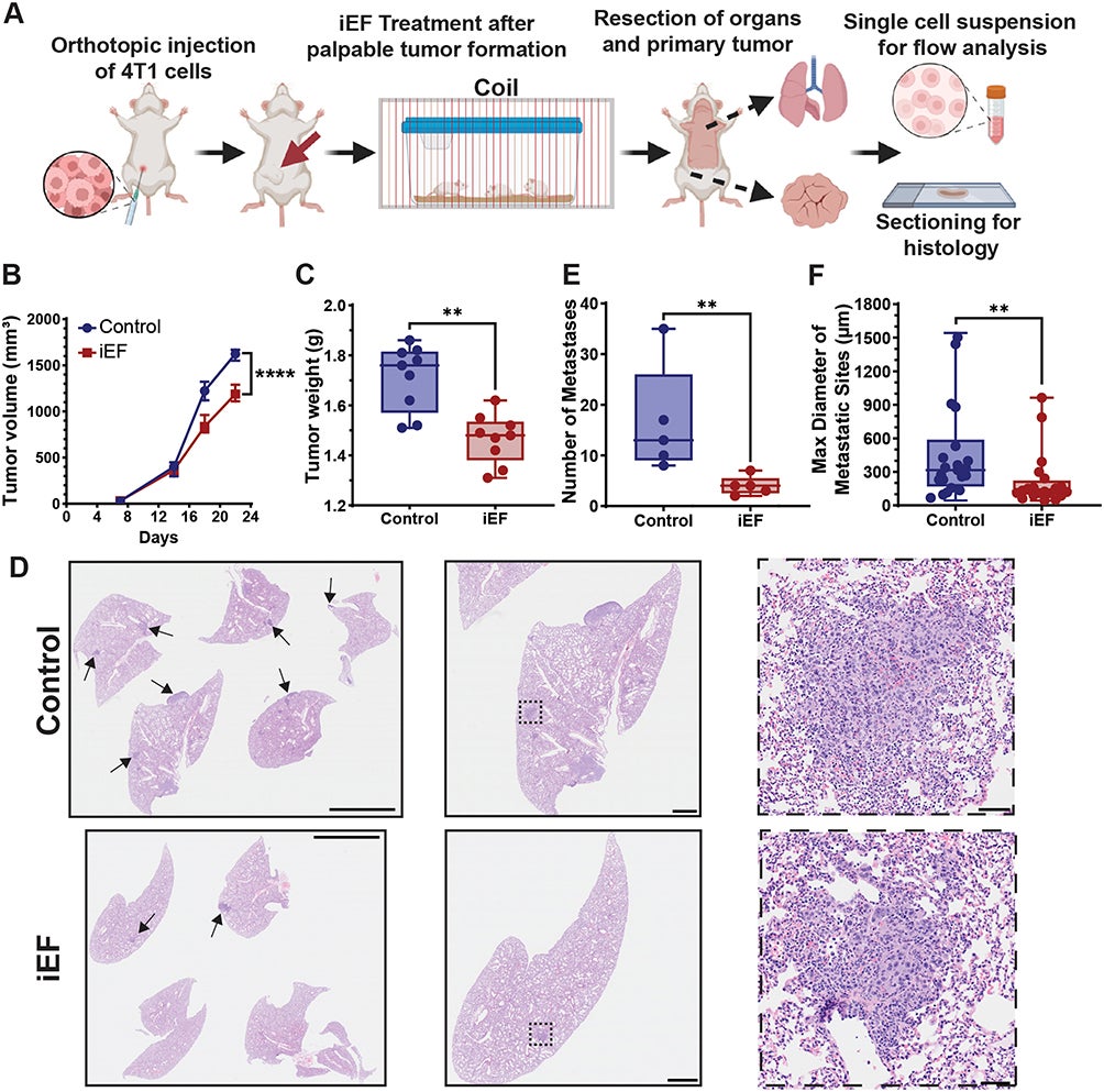  iEF inhibits TNBC tumor growth and metastasis.