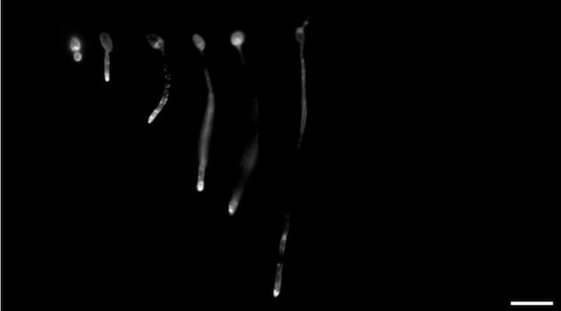 A fluorescent image of yeast cells growing into hyphae over time
