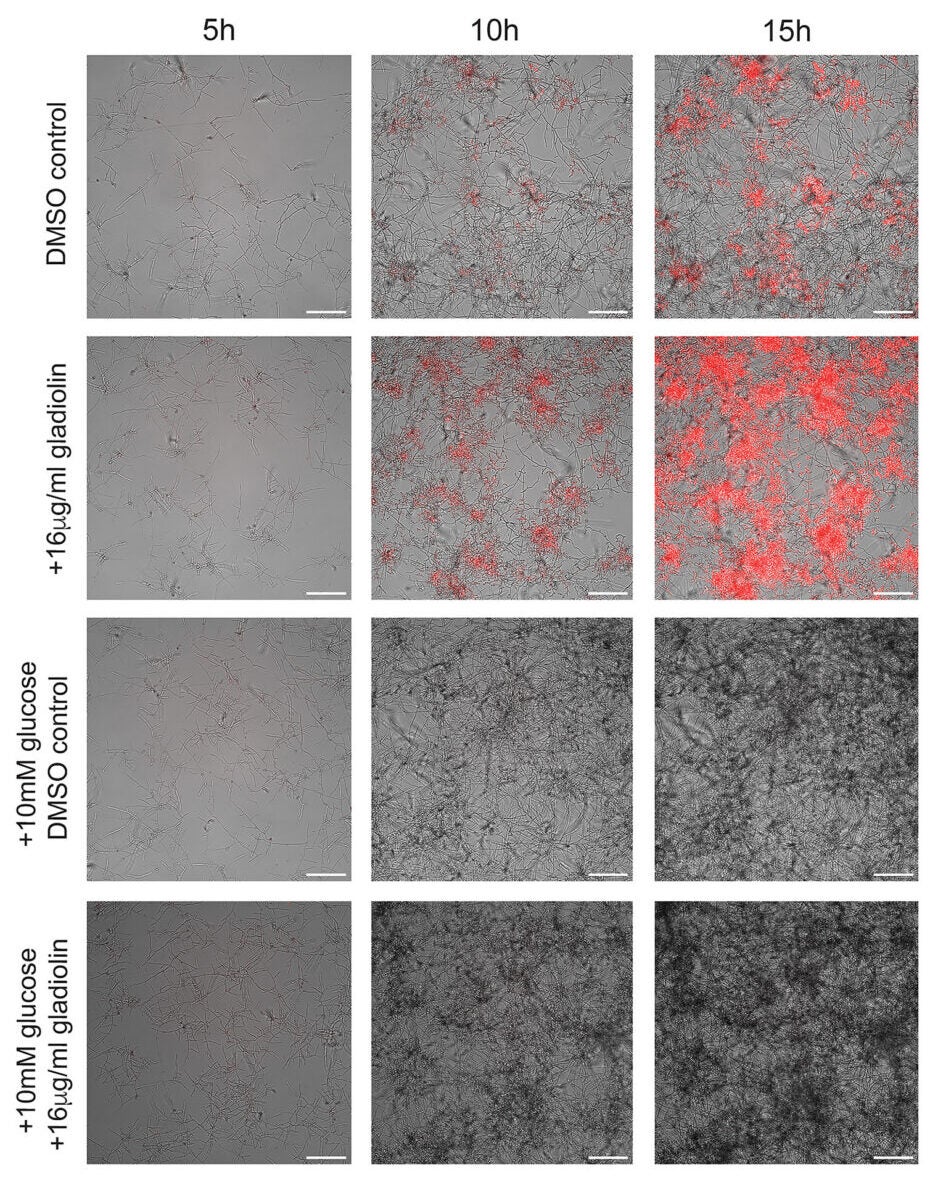 Glucose depletion is a signal for the hyphae-to-yeast transition