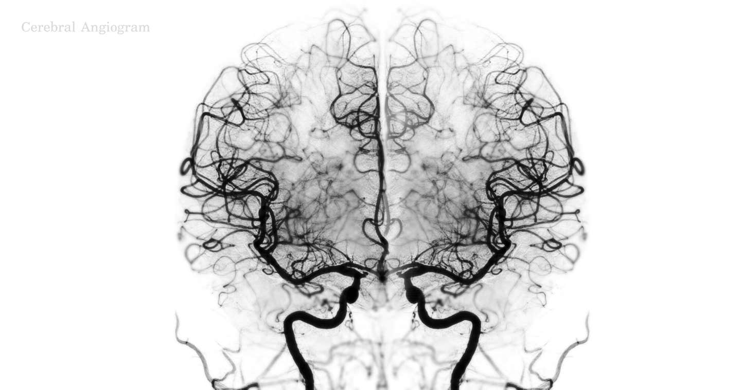 MIT neuroscientists found flexible neuron clusters that can store different kinds of information during a task.