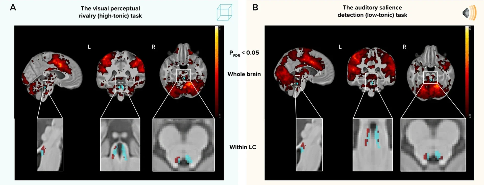 Recruitment of the LC during both tasks and associations with pupil responses.