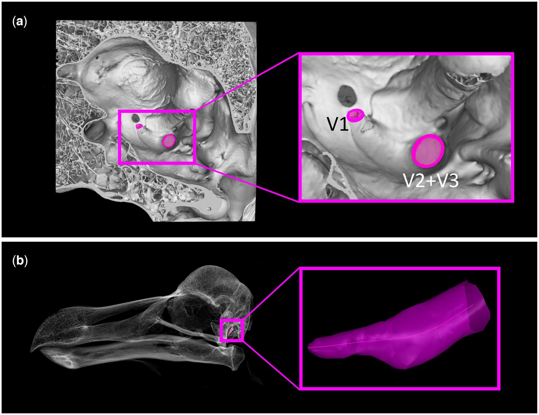 A, sagittal section of Raphus cucullatus (OUMNH-ZC-11605) skull, showing the trigeminal foramina for V1 and V2 + V3 from inside the neurocranial cavity. B, Lateral view of Raphus cucullatus (OUMNH-ZC-11605) transparent skull, showing the position of the endosseous cochlear duct, with a close up highlighting the medial point of the duct used to measure its length.
