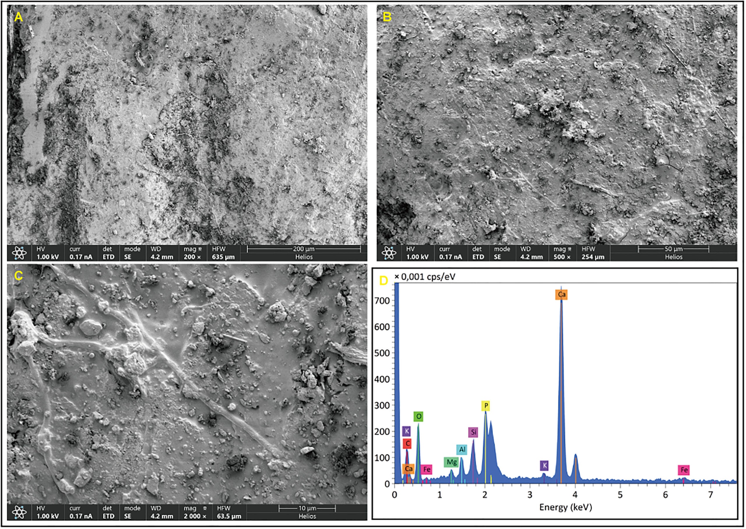 Microstructure and element contents from the stomach under SEM.