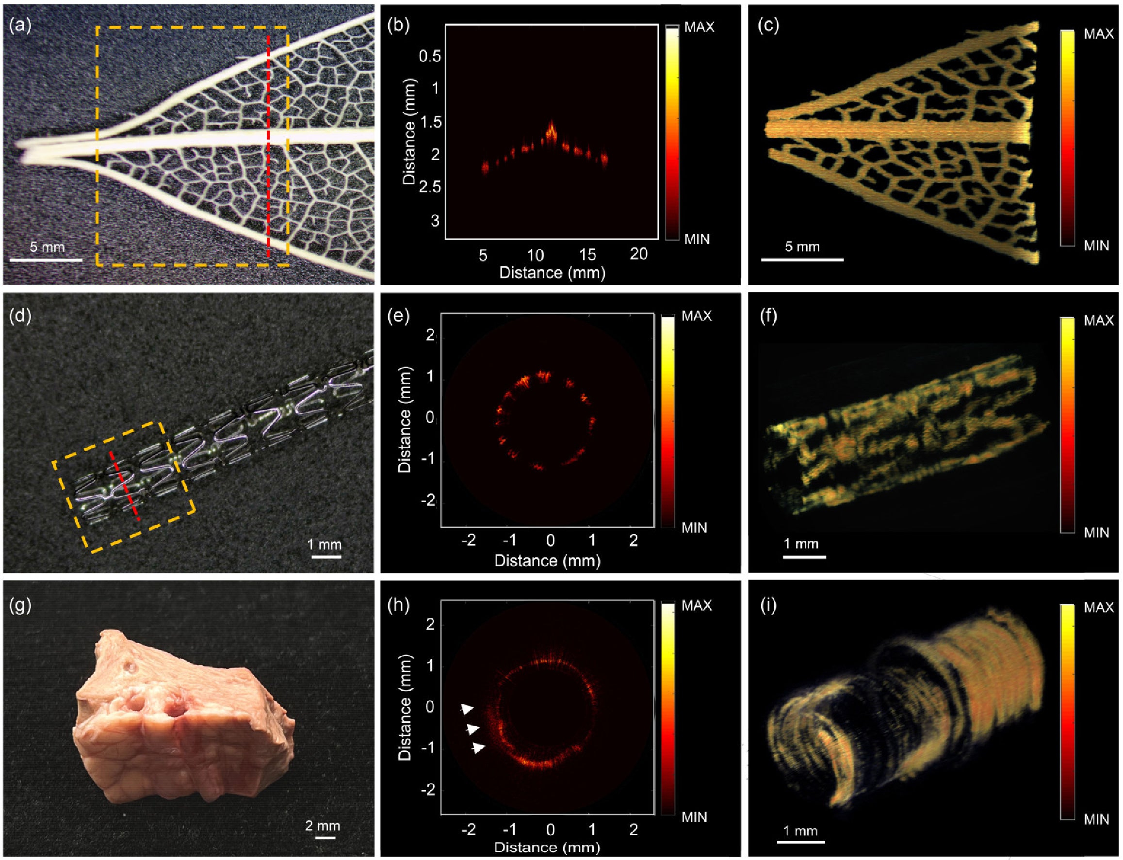 OCT images of a magnolia leaf, a vascular stent, and an ex vivo porcine vessel.