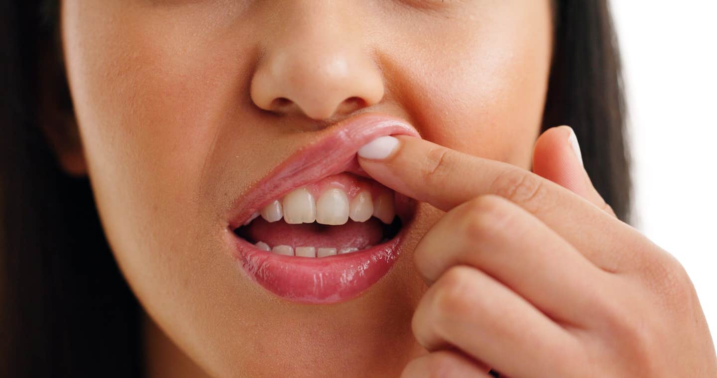 Scientists have developed a targeted therapy that removes harmful gum bacteria while protecting beneficial microbes, offering a new path for oral health.