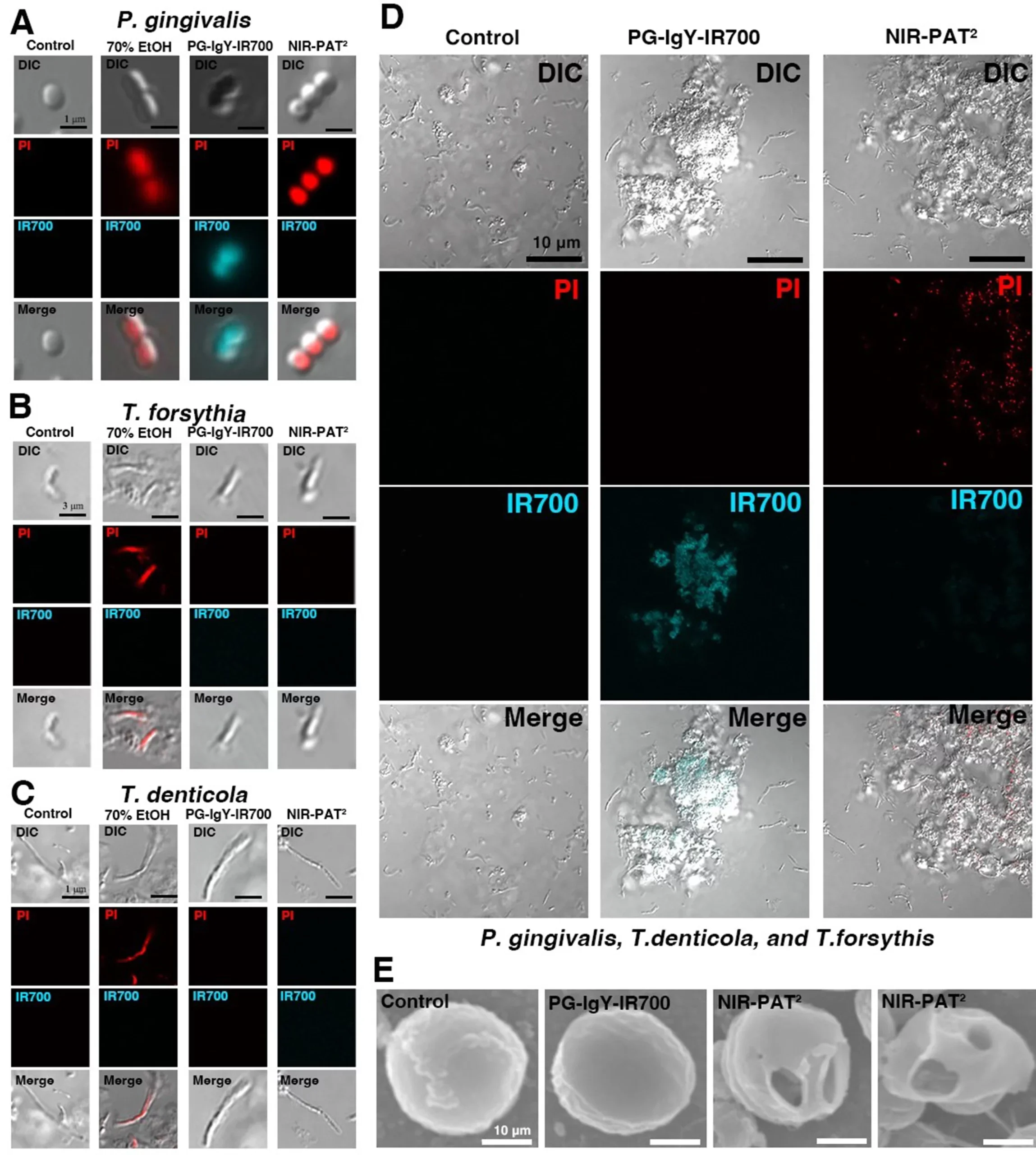 Bactericidal effect of NIR-PAT2 on P. gingivalis.