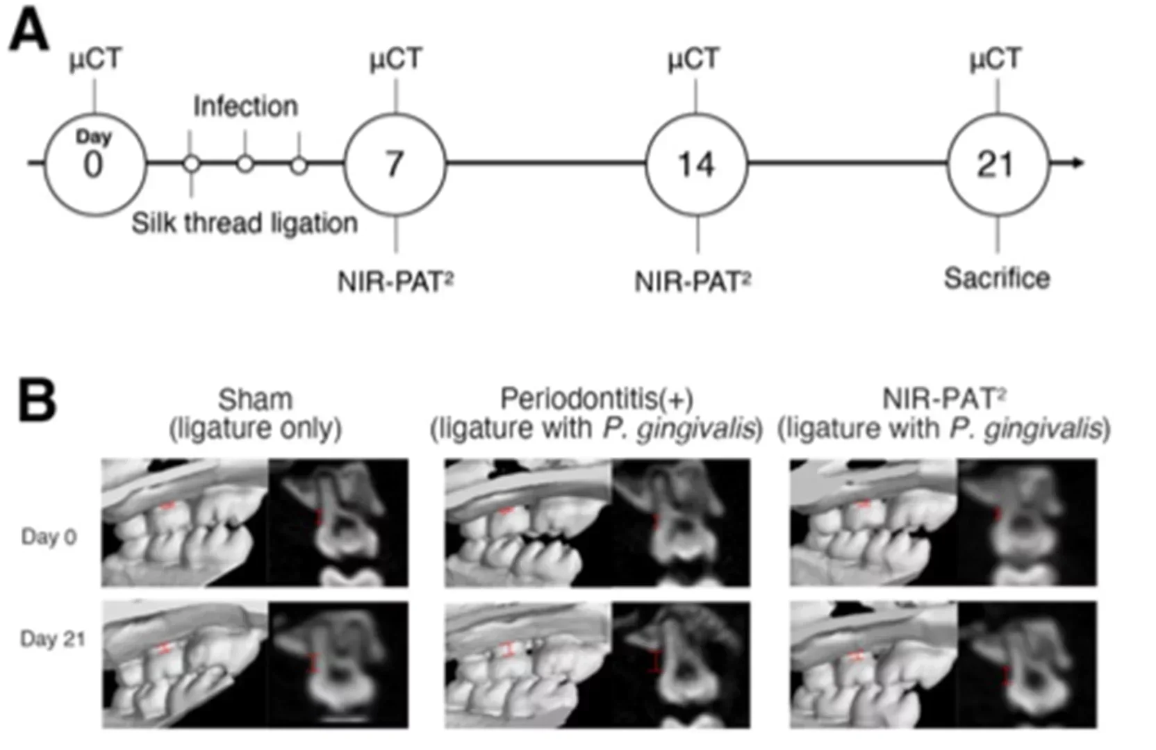 Therapeutic effects of NIR-PAT2 in a periodontitis mouse model.
