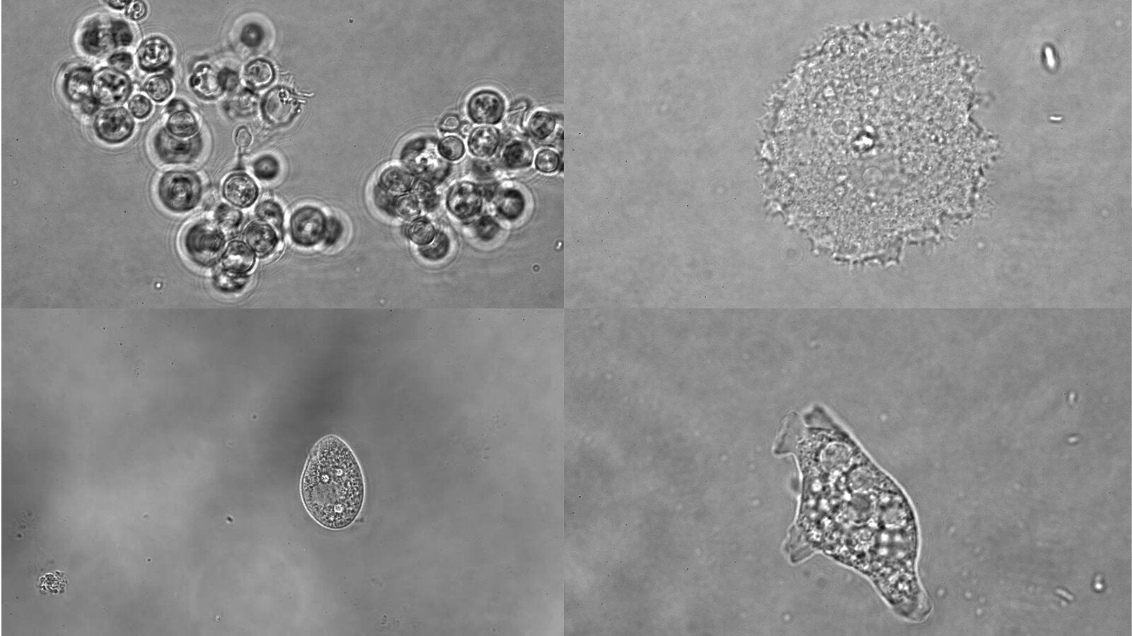 From top left clockwise: Spizellomyces punctatus, Acanthamoeba castellanii, Naegleria gruberi and Tetrahymena thermophila.