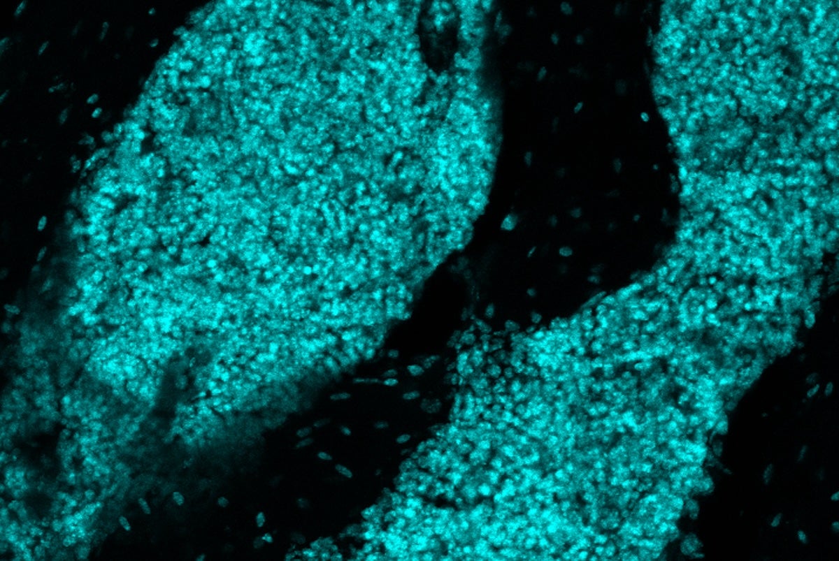 Researchers at WashU Medicine discovered lymph node-like structures (cyan) in the skull bone marrow of mice that play a role in mounting a rapid immune response in the brain.