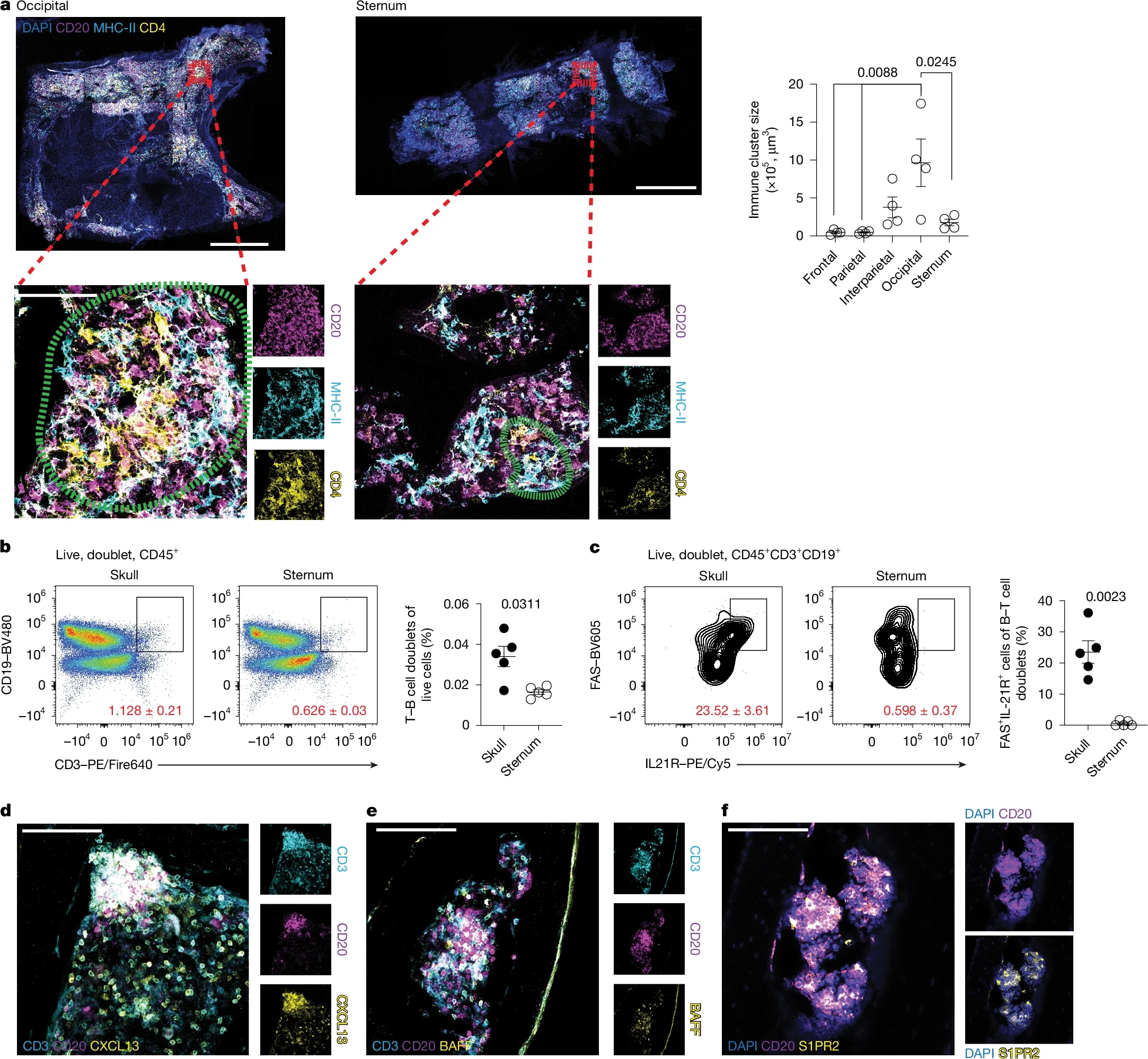 Skull BM contains lymphoid clusters.