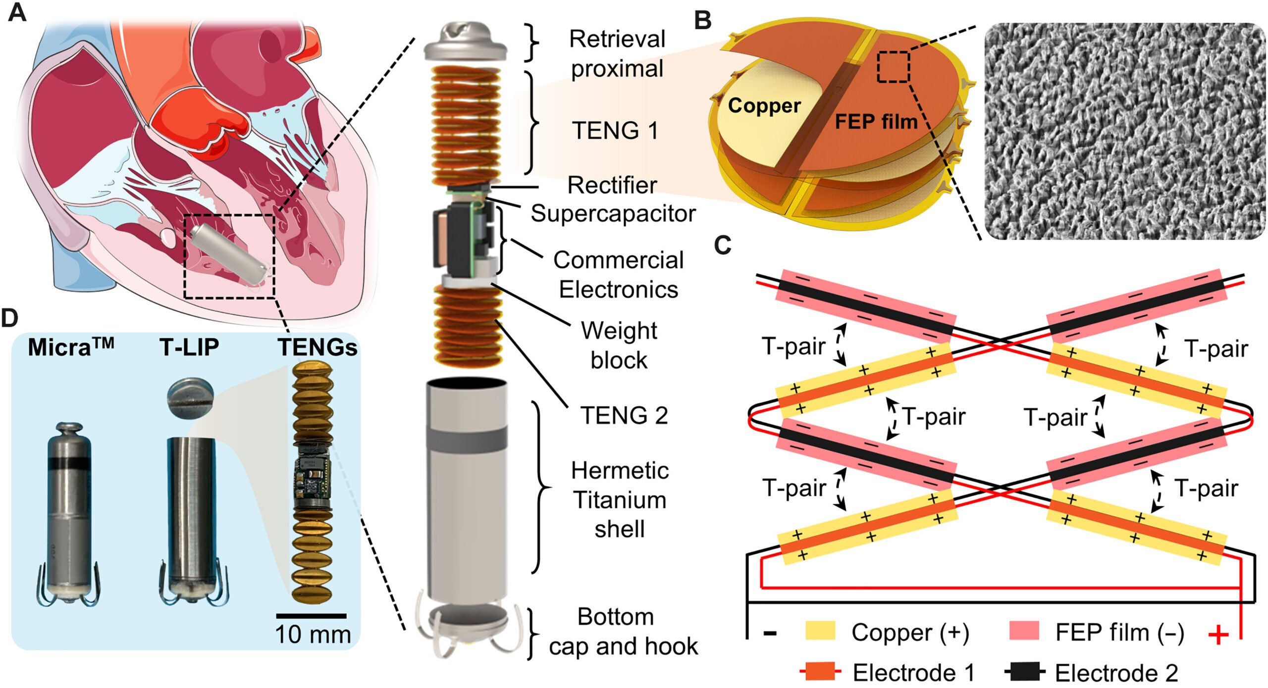 Design and operation principle of T-LIP.