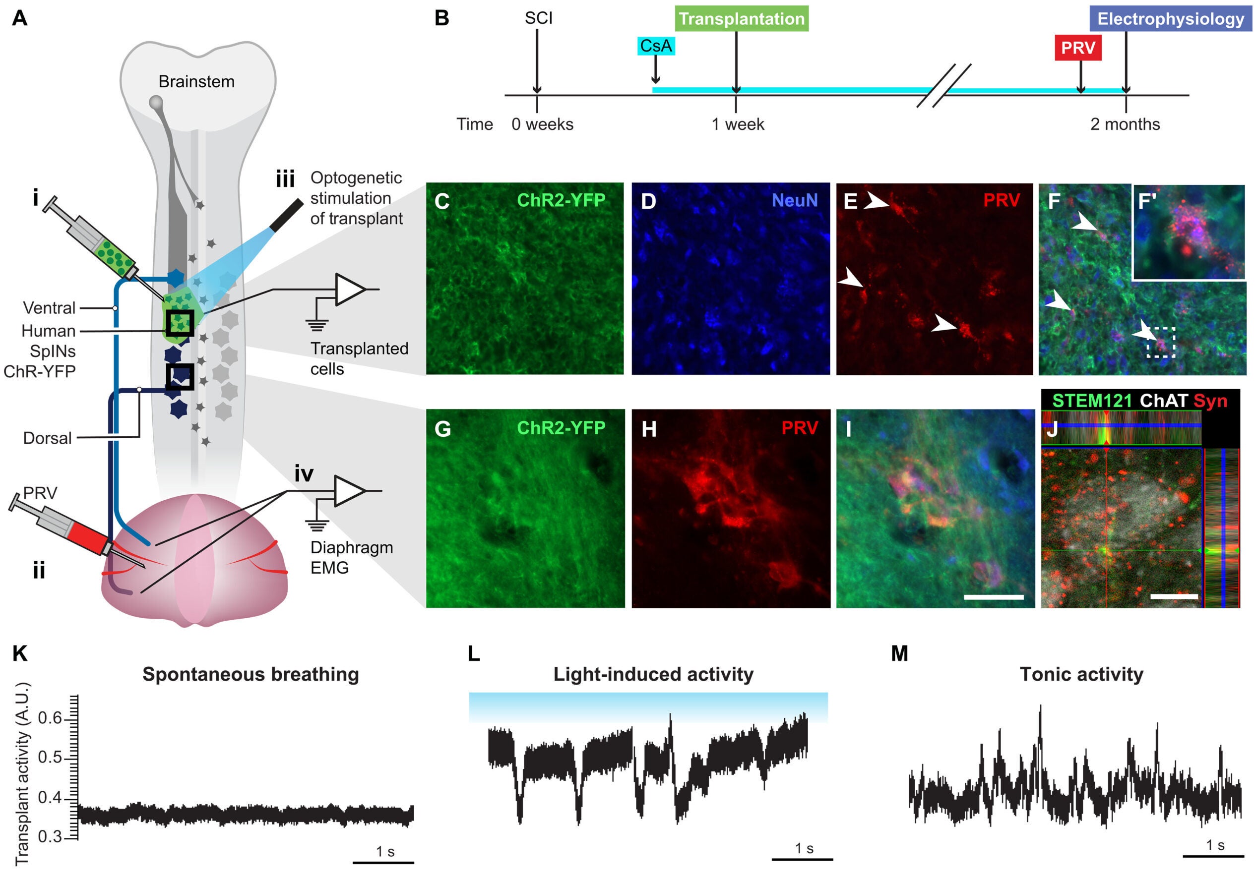 Transplanted V2a SpINs functionally integrate with injured host motor network.