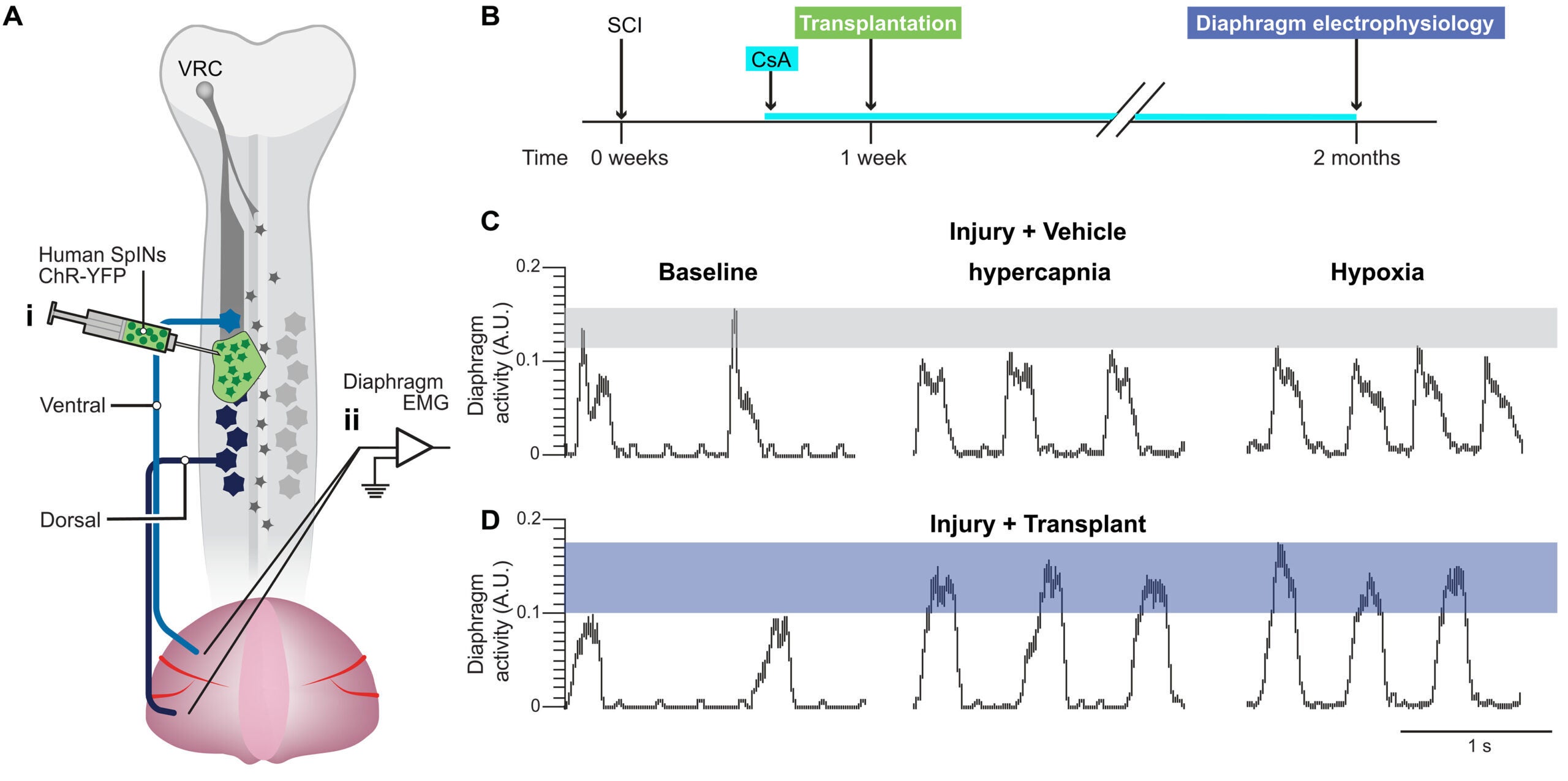 Human V2a SpINs promote respiratory recovery.