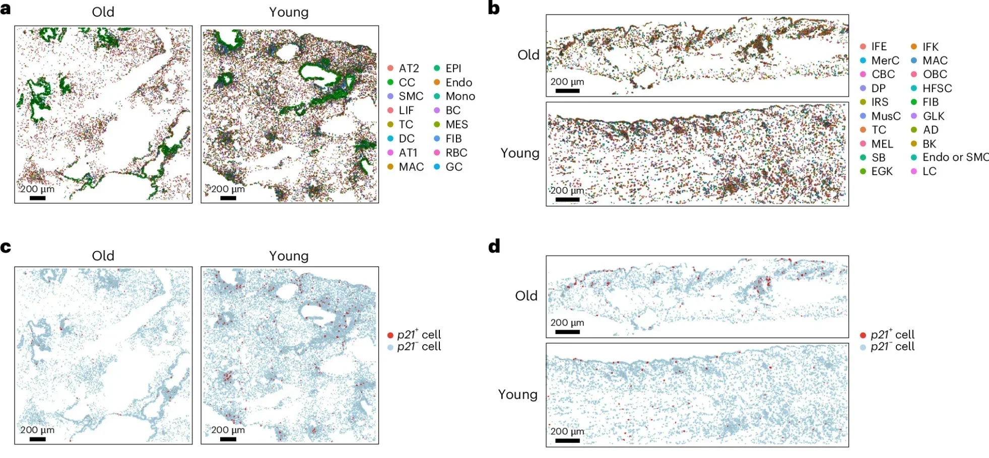 Spatial transcriptomic landscape of senescent cells in mouse lung and skin at different ages.