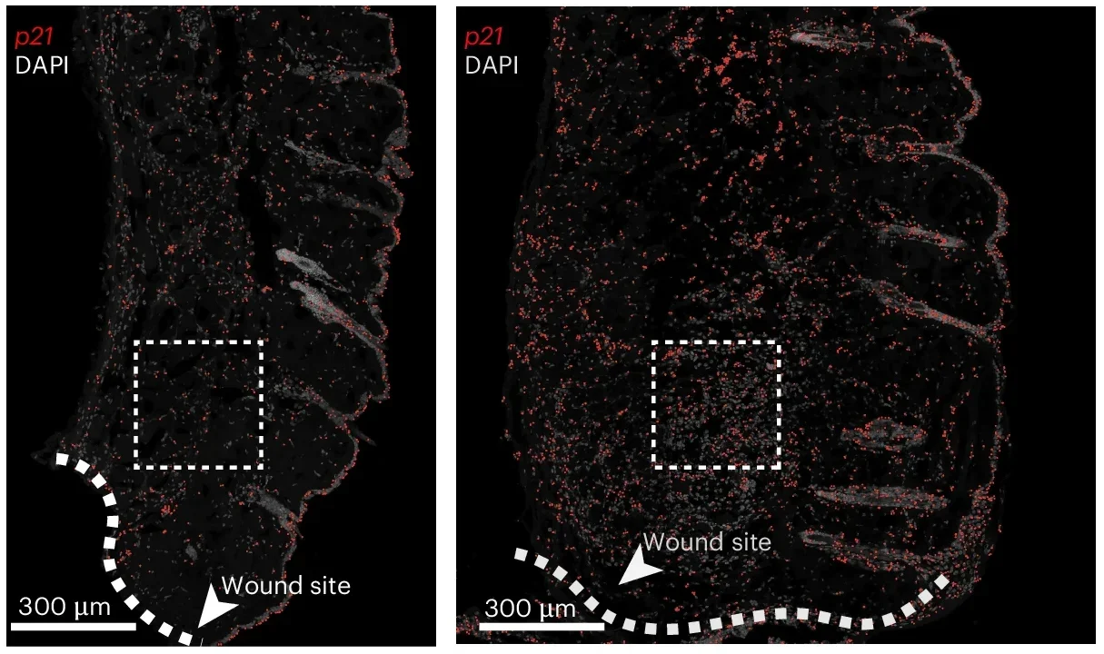 Validation of molecular and biochemical signatures in a mouse skin wound-healing model.