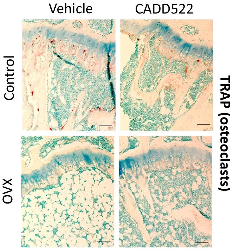 Representative TRAP staining of the tibial bone marrow below the growth plate in control and OVX mice. Scale bars = 100 µM.