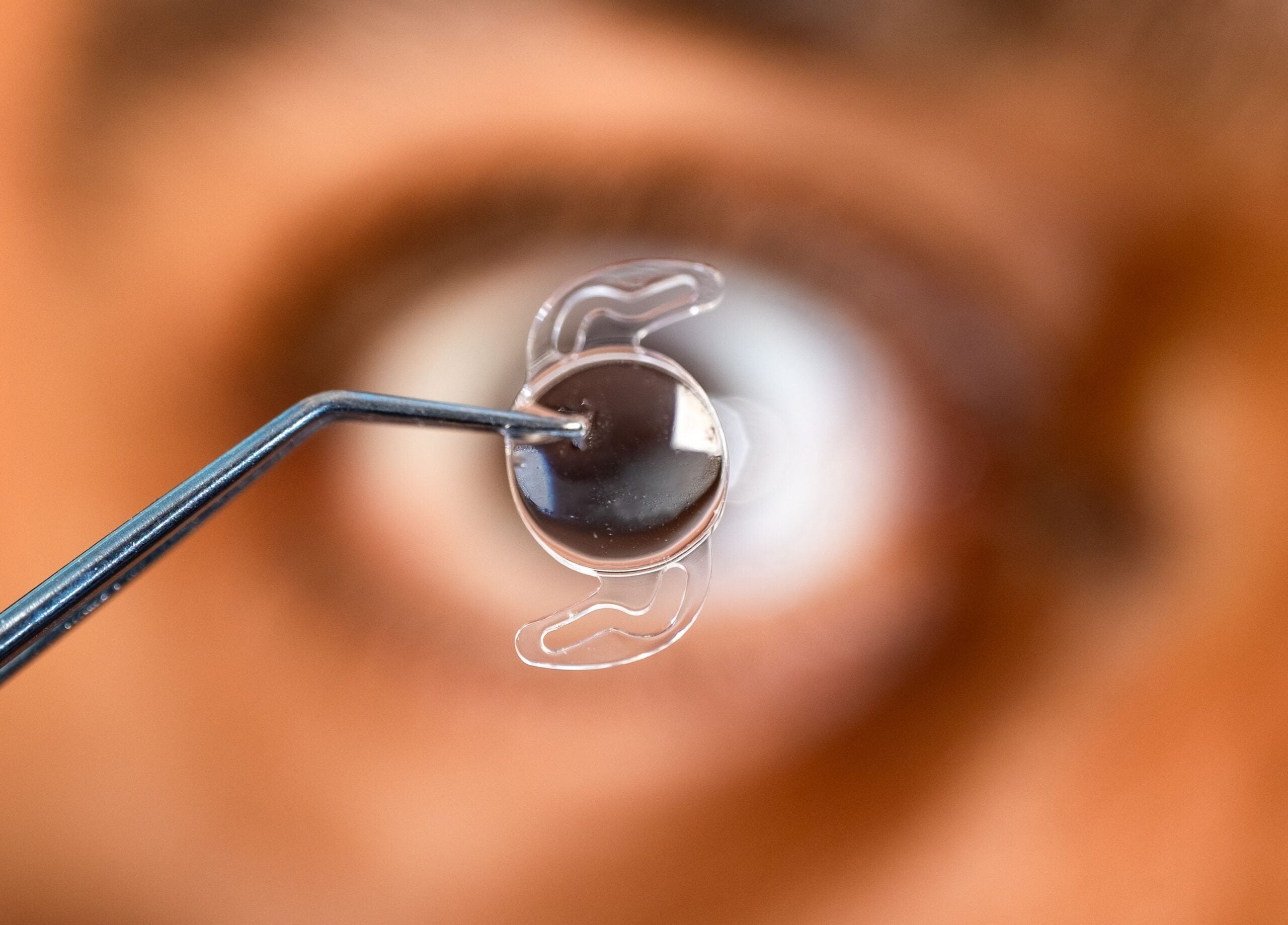 The investigators intentionally subjected the lenses to harsher conditions than would normally be expected during medical transport.