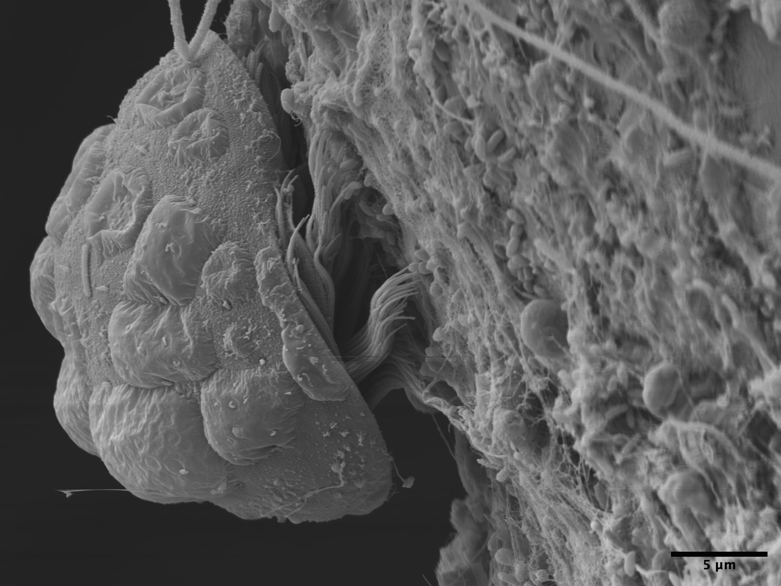 A protist parasite living on Tanystylum kiixin.