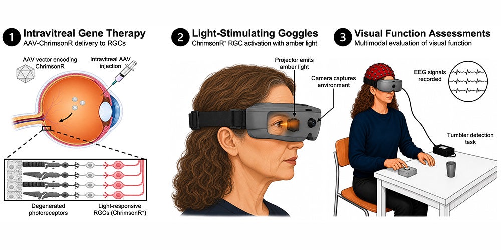 Diagram of the new therapy. ① Gene therapy makes retinal cells light-sensitive. ② Special glasses convert the image from a built-in camera into light stimuli to which the retinal cells respond. ③ Various tests were conducted to determine, for example, whether participants could perceive a tumbler. 
