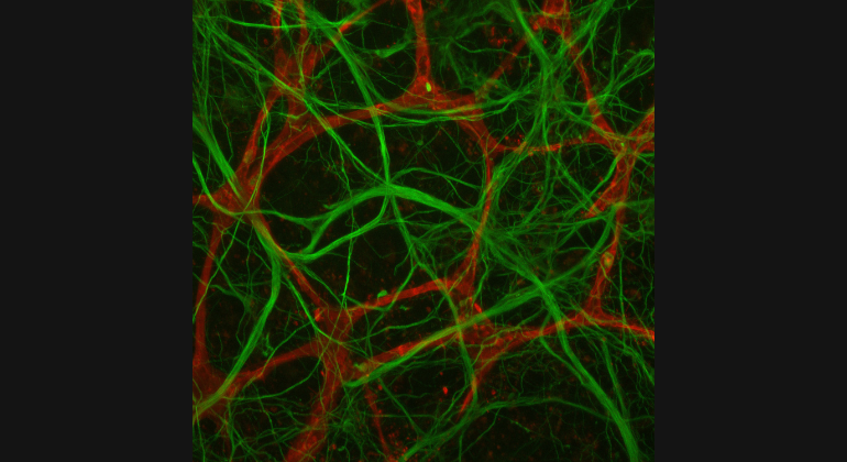 miBrain, or human brain tissue derived from induced pluripotent stem cells, on a cell culture plate.