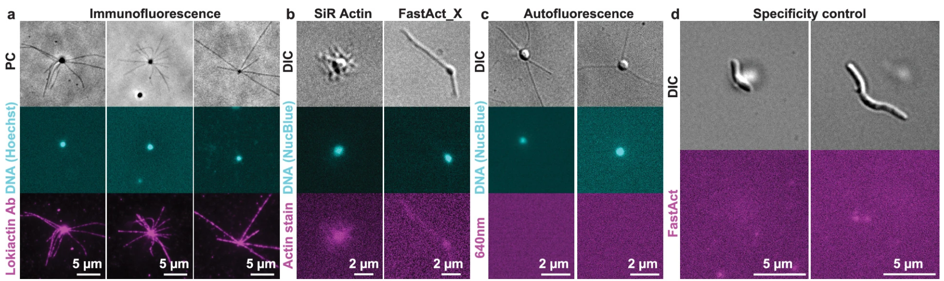 Controls for fluorescent imaging and actin inhibitor effects on L. ossiferum.