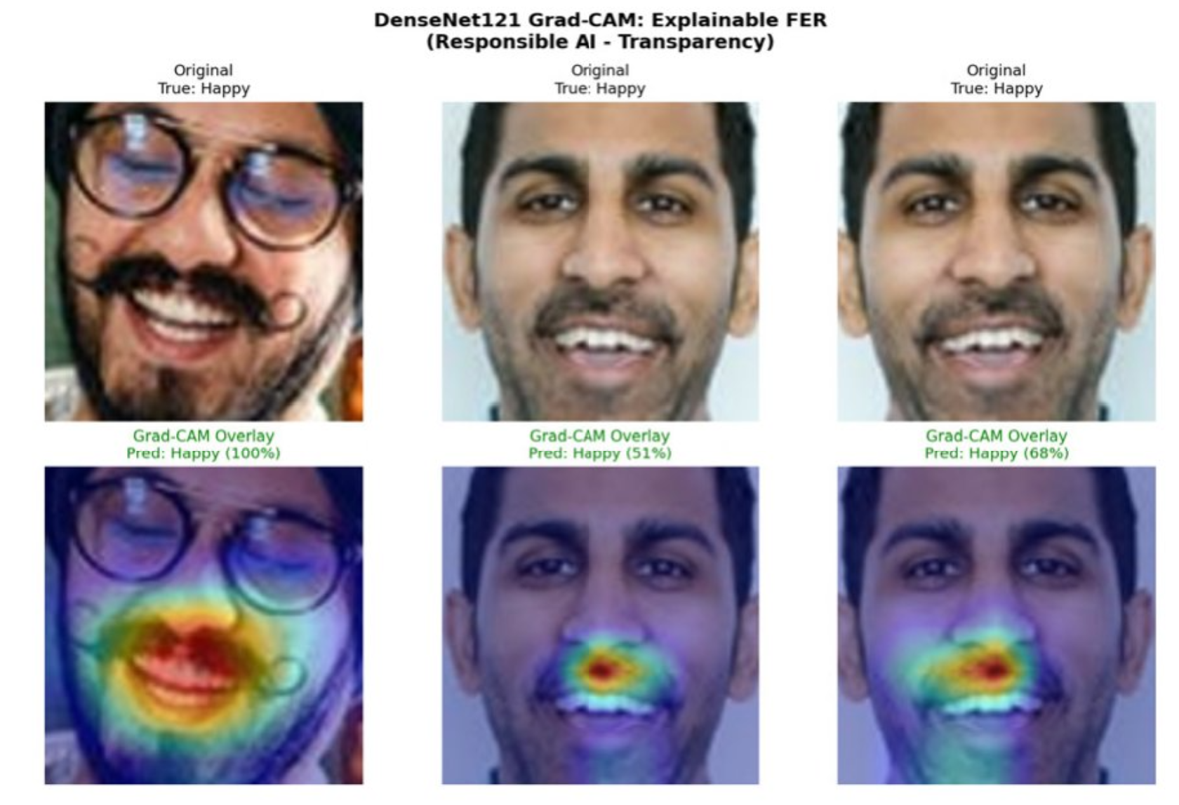 Grad-CAM visualisation for DenseNet121. The model attends to the mouth region for happy expressions, consistent with AU12 (lip corner puller).