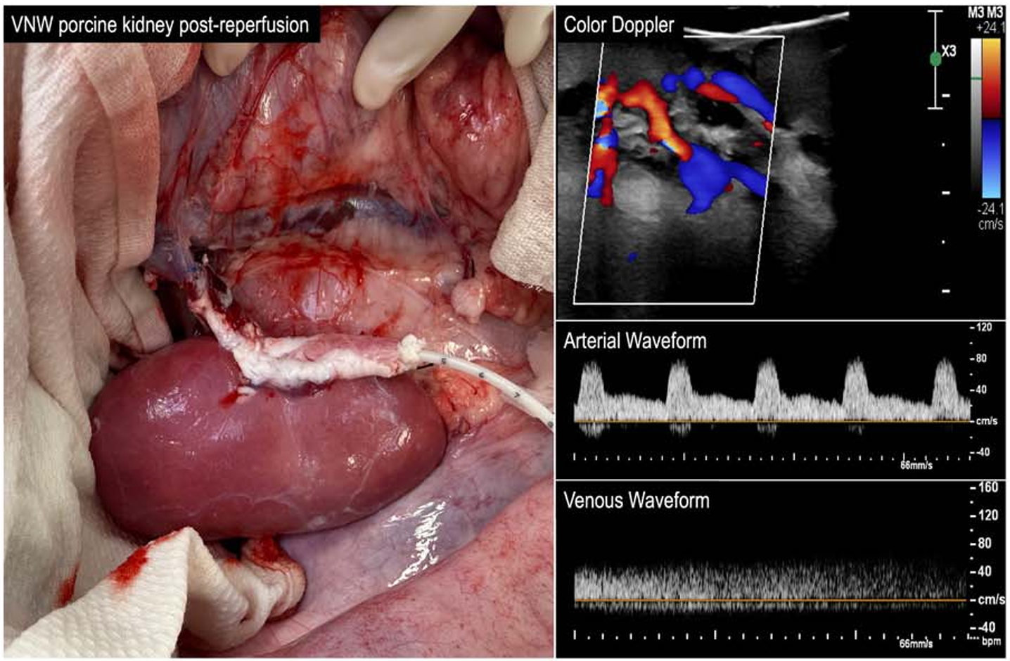 Gross appearance of a VNW kidney immediately following reperfusion, with color Doppler ultrasound demonstrating arterial and venous perfusion throughout the renal parenchyma and spectral Doppler waveforms demonstrating renal arterial and venous flow.