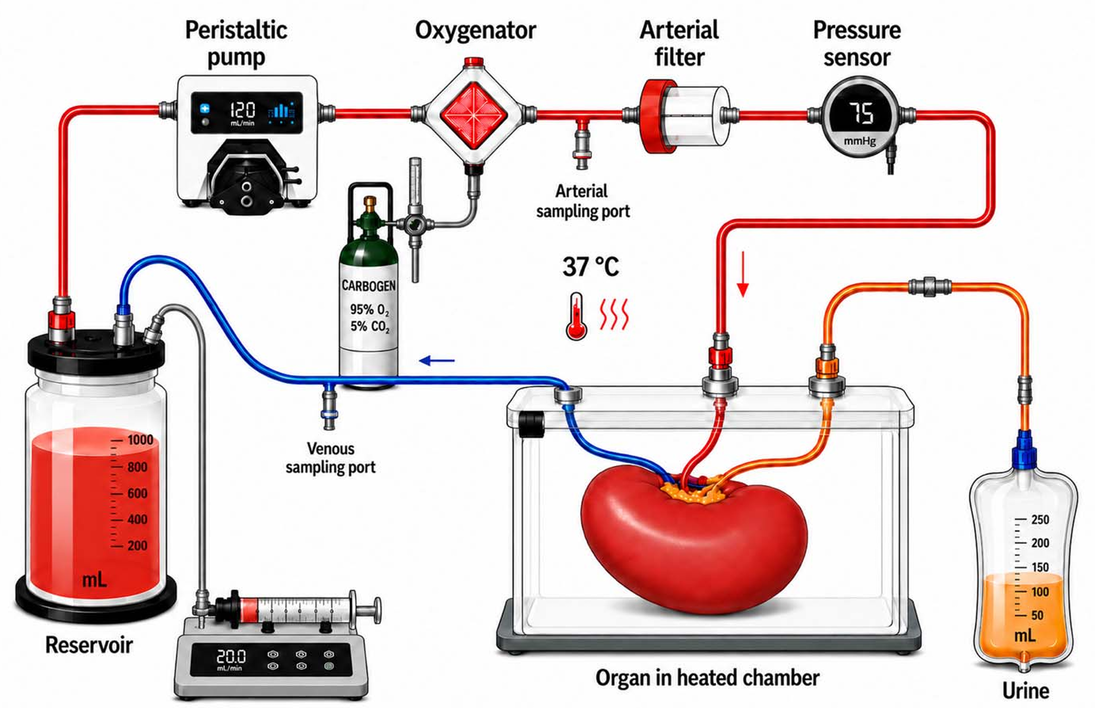  Normothermic machine perfusion (NMP) circuit for porcine kidney assessment. Schematic of the recycling NMP circuit used to assess recovered kidneys.