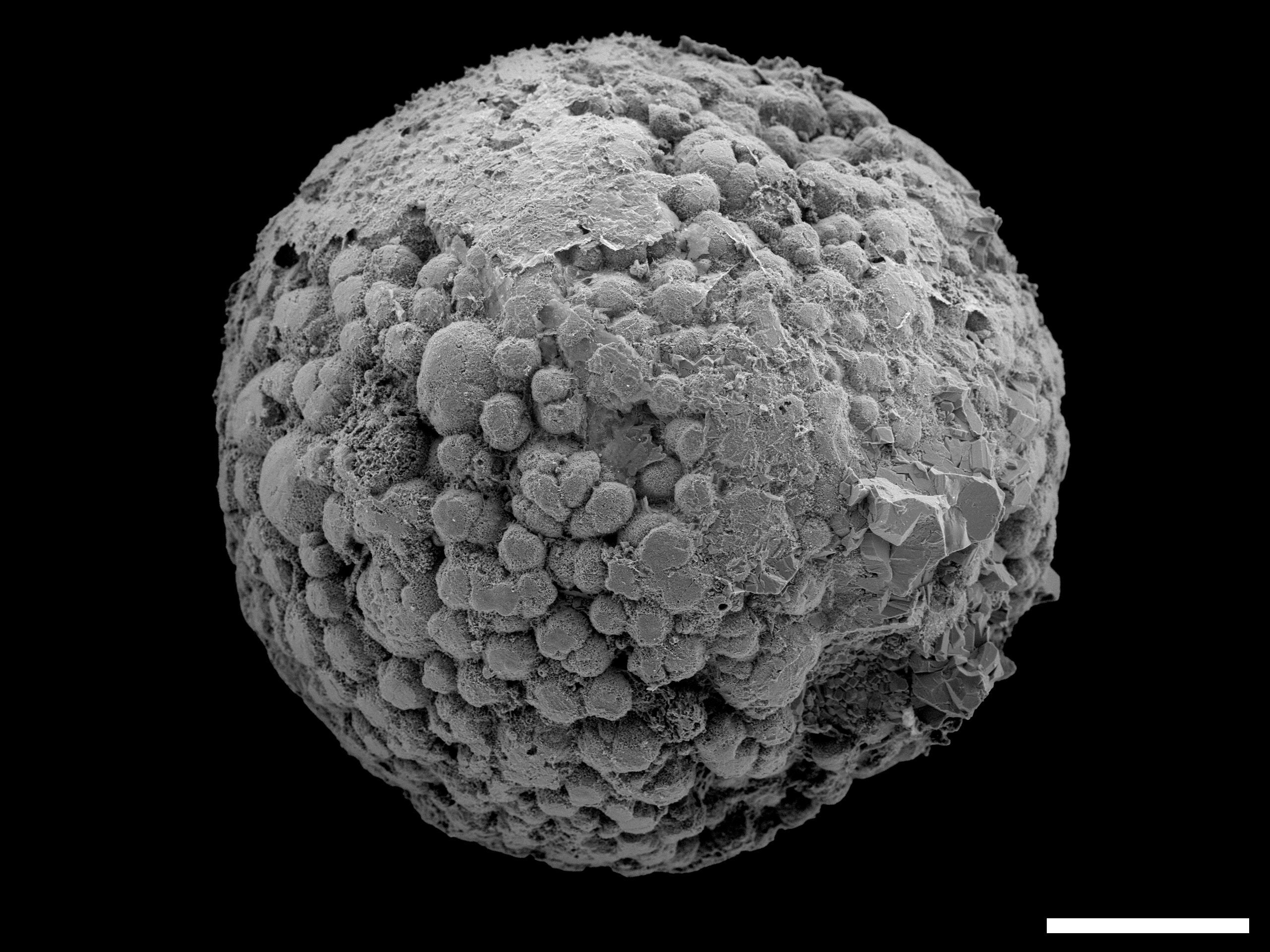 Knollisphaeridium maximum, Kheseen Formation, latest Ediacaran/early Cambrian. Scale bar: 0.1 mm.