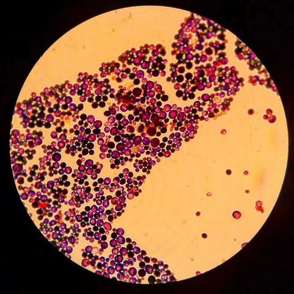 A bacterial compound changes how Candida uses glucose, weakening a shape shift linked to dangerous infections.