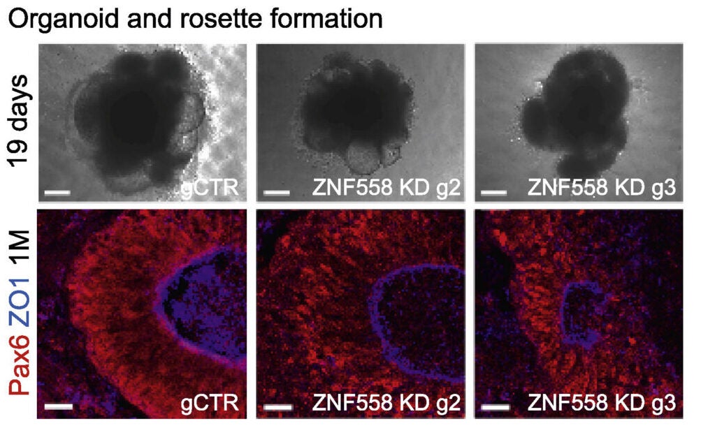Pictures of iPSCs-derived cerebral organoids in the culture dish (top, day 19; scale bar, 200 μm) and after immunohistochemistry for Pax6/ZO1 (bottom, 1 month; scale bar, 25 μm).