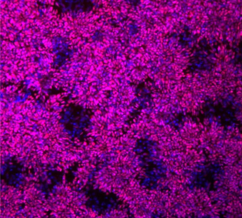 Neural stem cells from chimpanzees.